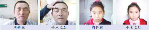 > 正文         斜视不仅影响视力,影响美容,儿童时期发病的斜视,立体