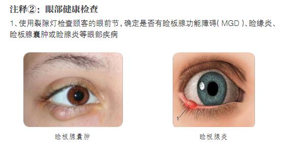 注释2：眼部健康健康检查。1、使用裂隙灯检查顾客的眼前节，确定是否有睑板腺功能障碍（MGD）、睑缘炎、睑板腺囊肿或睑腺炎等眼部疾病